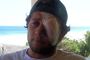 Parker Coffin sofreu acidente grave a surfar no Soup Bowl