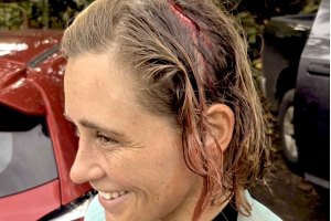 Yolanda Hopkins mostra compromisso total no North Shore após acidente em Jockos