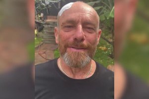 Tom Carroll foi hospitalizado após acidente na Austrália