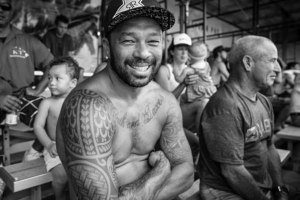 SUNNY GARCIA SUBMETIDO A CIRURGIA AOS PULMÕES APÓS CONTRAIR PNEUMONIA