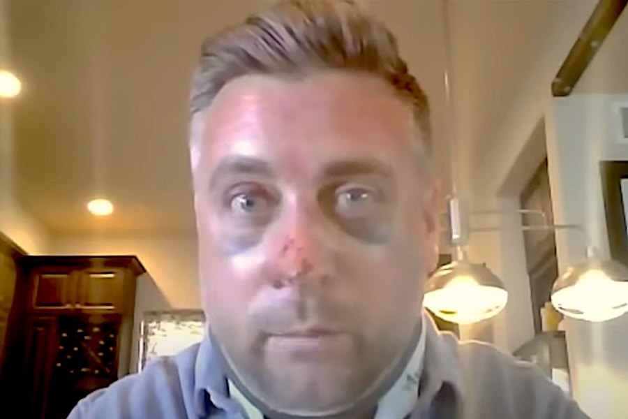 O ex Policia falou à Fox News